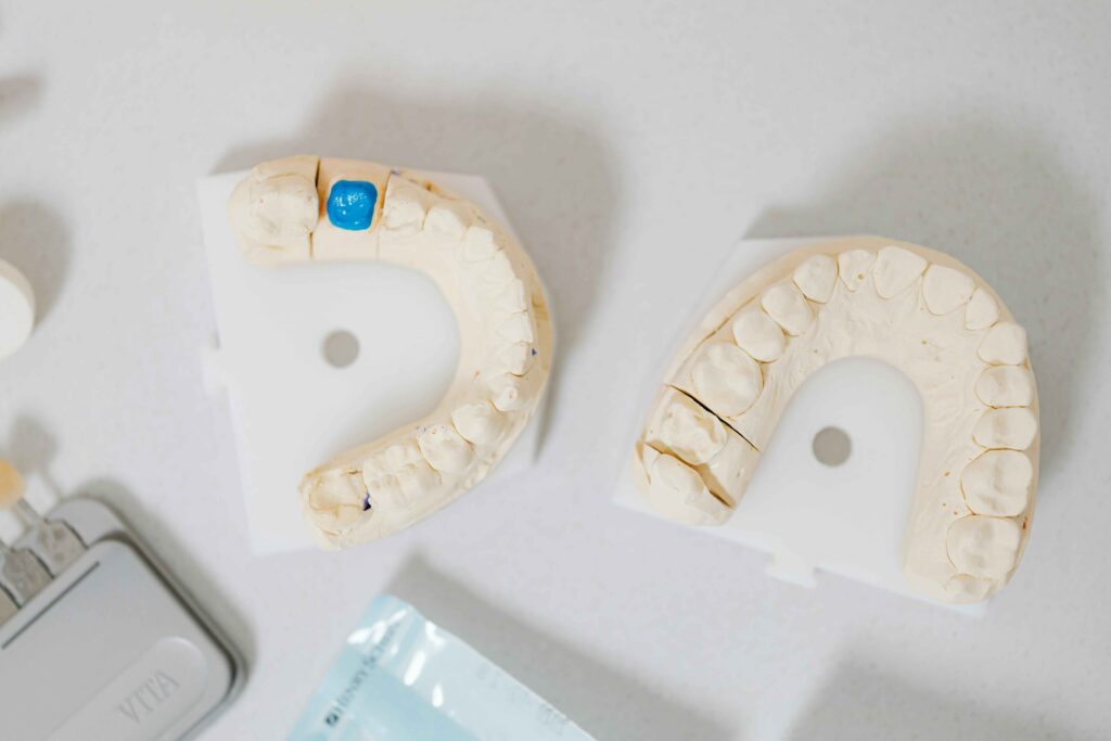 tooth with cavity filling