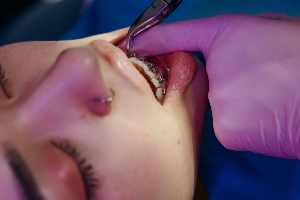 checking braces on patient