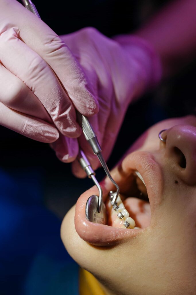 girl getting braces