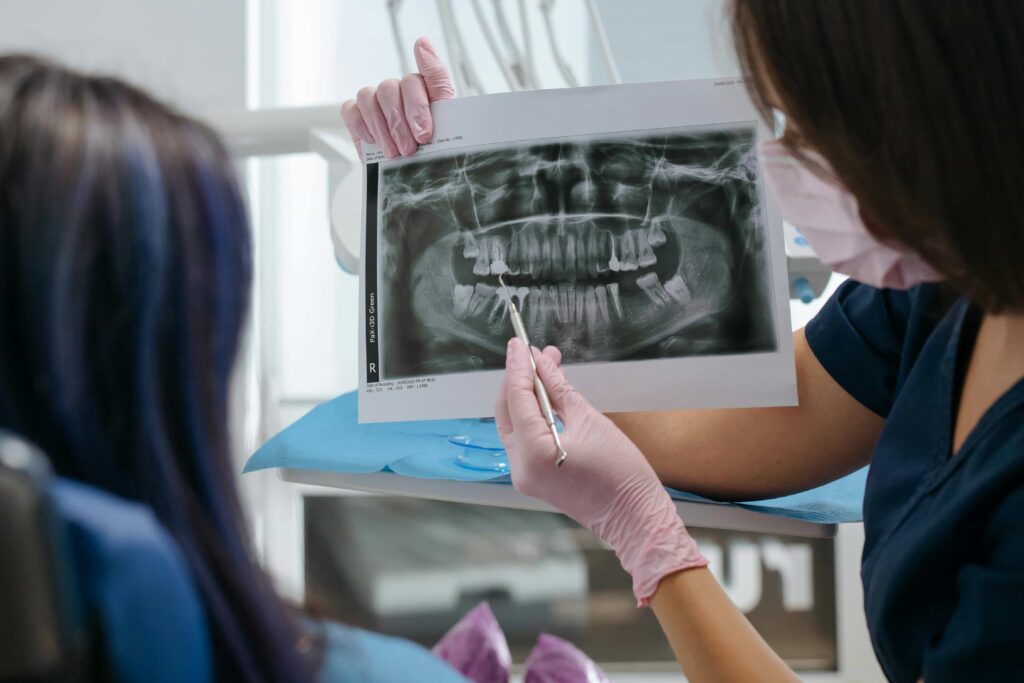 x ray for cavities and braces