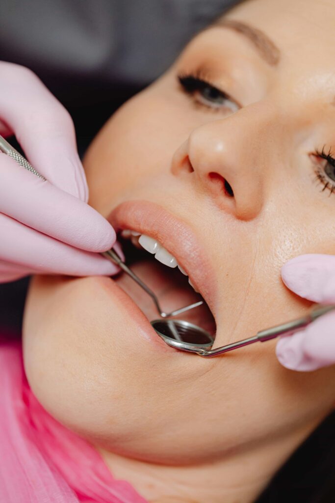 woman with cavities